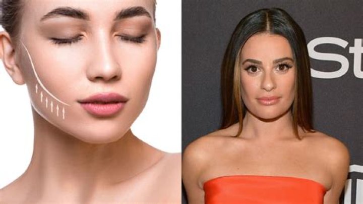 Celebs Buccal Fat Removal: The Ultimate Guide to a Slimmer Facial Contour