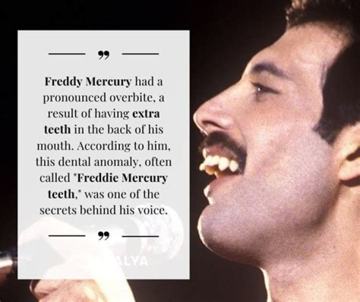 Freddy Mercury Teeth: The Iconic Smile That Defined a Legend